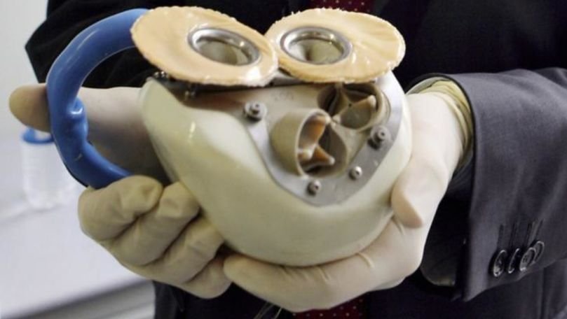 Premieră medicală: Prima inimă complet artificială a primit aviz pozitiv pentru vânzare