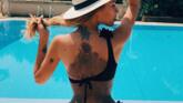 Yulianna Yussef s-a născut cu un nevus imens, care i-a acoperit o mare parte a corpului foto-03
